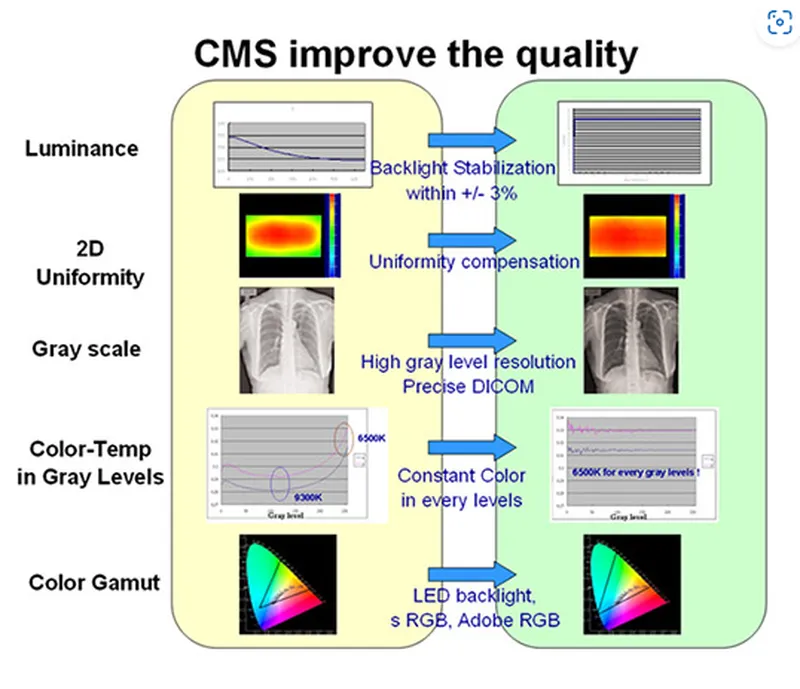 中光電醫療級顯示器色彩管理系統