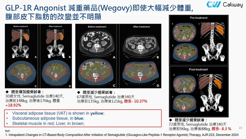 康霈生技GLP-1R Angonist 減重藥品(Wegovy)成效